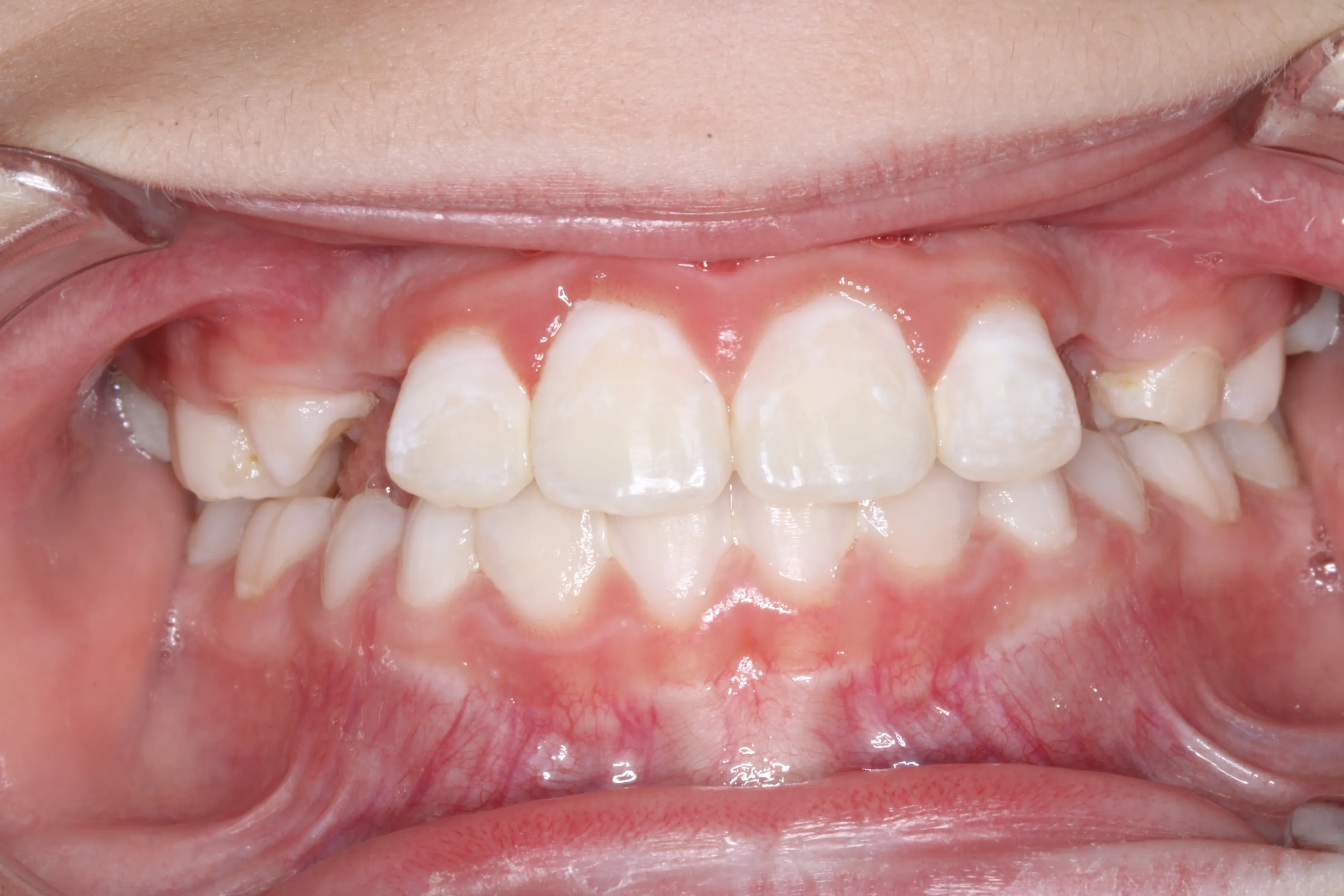 smile-gallery gallery